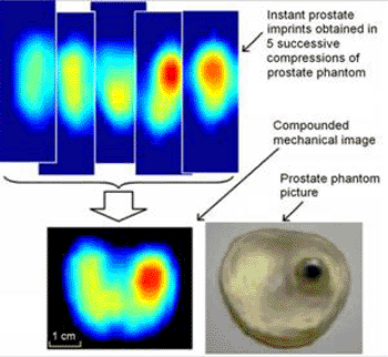 Image: Real-time reconstruction of a 2-D image of a prostate phantom (Photo courtesy of ProUroCare).